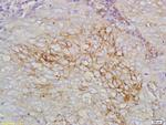 STEAP1 Antibody in Immunohistochemistry (Paraffin) (IHC (P))