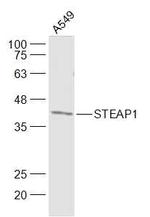 STEAP1 Antibody in Western Blot (WB)