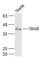Stra8 Antibody in Western Blot (WB)