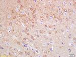 Synphilin 1 Antibody in Immunohistochemistry (Paraffin) (IHC (P))