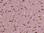 Phospho-NeuroD1 (Ser274) Antibody in Immunohistochemistry (Paraffin) (IHC (P))