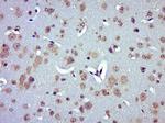 UCP-2 Antibody in Immunohistochemistry (Paraffin) (IHC (P))