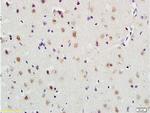 PLAUR Antibody in Immunohistochemistry (Paraffin) (IHC (P))