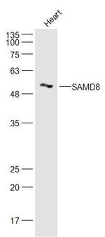 SAMD8 Antibody in Western Blot (WB)