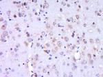 WRCH-1 Antibody in Immunohistochemistry (Paraffin) (IHC (P))