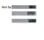 WNT5A Antibody in Western Blot (WB)