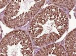 NUDCD1 Antibody in Immunohistochemistry (Paraffin) (IHC (P))