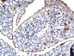 BSEP/ABCB11 Antibody in Immunohistochemistry (Paraffin) (IHC (P))