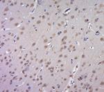 VEGF-A Antibody in Immunohistochemistry (Paraffin) (IHC (P))