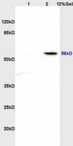 ABI1 Antibody in Western Blot (WB)