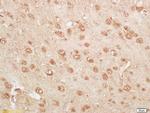 Kallikrein 14 Antibody in Immunohistochemistry (Paraffin) (IHC (P))