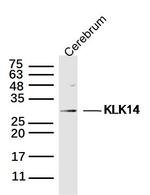 Kallikrein 14 Antibody in Western Blot (WB)