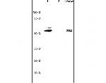 Matrilin 1 Antibody in Western Blot (WB)