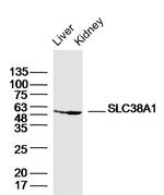 SLC38A1 Antibody in Western Blot (WB)