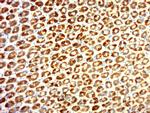 SLC39A4 Antibody in Immunohistochemistry (Paraffin) (IHC (P))