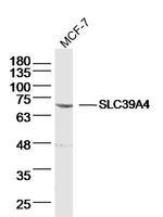 SLC39A4 Antibody in Western Blot (WB)