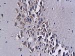 MCP-3/CCL7 Antibody in Immunohistochemistry (Paraffin) (IHC (P))