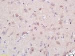 Menin Antibody in Immunohistochemistry (Paraffin) (IHC (P))