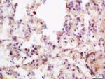 Menin Antibody in Immunohistochemistry (Paraffin) (IHC (P))