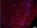 Phospho-Src (Ser75) Antibody in Immunohistochemistry (Paraffin) (IHC (P))