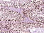 Phospho-Src (Ser75) Antibody in Immunohistochemistry (Paraffin) (IHC (P))