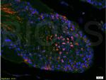 mTOR/FRAP Antibody in Immunohistochemistry (Paraffin) (IHC (P))