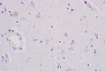 PCNA-proliferation Marker Antibody in Immunohistochemistry (Paraffin) (IHC (P))