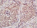 PCNA [proliferation Marker] Antibody in Immunohistochemistry (Paraffin) (IHC (P))