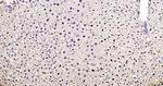 Phospho-FoxO1 (Ser319) Antibody in Immunohistochemistry (Paraffin) (IHC (P))