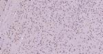 Phospho-FoxO1 (Ser319) Antibody in Immunohistochemistry (Paraffin) (IHC (P))