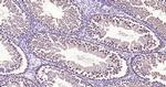 Phospho-FoxO1 (Ser319) Antibody in Immunohistochemistry (Paraffin) (IHC (P))