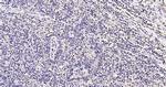 Phospho-FoxO1 (Ser319) Antibody in Immunohistochemistry (Paraffin) (IHC (P))