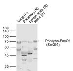 Phospho-FoxO1 (Ser319) Antibody in Western Blot (WB)