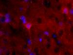 S100B Antibody in Immunohistochemistry (Paraffin) (IHC (P))