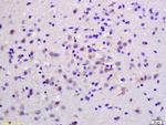 S100B Antibody in Immunohistochemistry (Paraffin) (IHC (P))