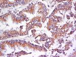 AMPK beta 1 Antibody in Immunohistochemistry (Paraffin) (IHC (P))