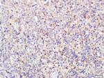 Neurogenic locus notch homolog protein 1 Antibody in Immunohistochemistry (Paraffin) (IHC (P))