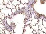 Neurogenic locus notch homolog protein 1 Antibody in Immunohistochemistry (Paraffin) (IHC (P))