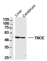 TBCE Antibody in Western Blot (WB)