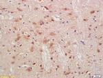 PMP2 Antibody in Immunohistochemistry (Paraffin) (IHC (P))