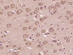 VEGFA Antibody in Immunohistochemistry (Paraffin) (IHC (P))