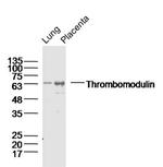 Thrombomodulin Antibody in Western Blot (WB)