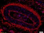 CK18 Antibody in Immunohistochemistry (Paraffin) (IHC (P))