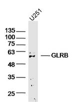 GLRB Antibody in Western Blot (WB)