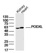 PODXL Antibody in Western Blot (WB)