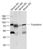 Transferrin Antibody in Western Blot (WB)