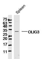 OLIG3 Antibody in Western Blot (WB)