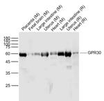 GPR30 Antibody in Western Blot (WB)