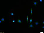 GPR30 Antibody in Immunocytochemistry (ICC/IF)