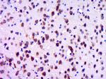 GPR30 Antibody in Immunohistochemistry (Paraffin) (IHC (P))